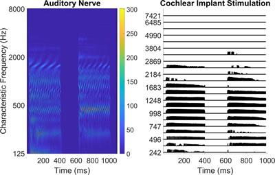Computer-based musical interval training program for Cochlear implant users and listeners with no known hearing loss